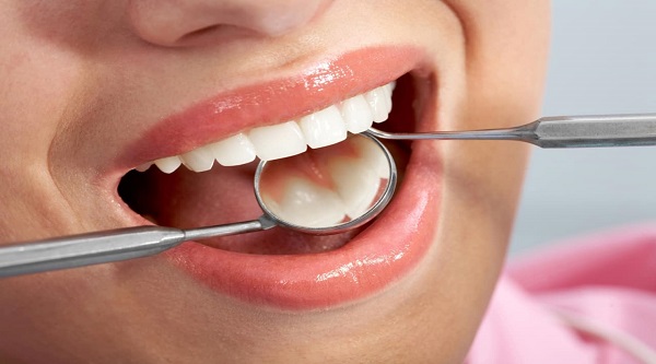 Tips Of Prevent Cavities: क्या आप भी दांतों की कैविटीज से हैं परेशान? इन उपायों का करें पालन