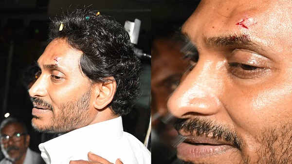 CM Jagan Mohan Reddy injured: आंध्रप्रदेश के सीएम जगन मोहन रेड्डी के काफिले पर पथराव; सीएम के सर में आई चोट